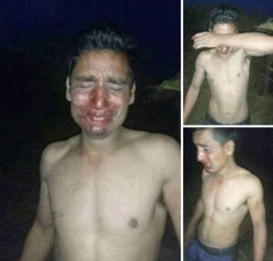 एक दलित युवा एमालेबाट कांग्रेसमा प्रवेश गरेकै कारण आफ्नै साथीबाट रगताम्य हुने गरी कुटाइ खाए